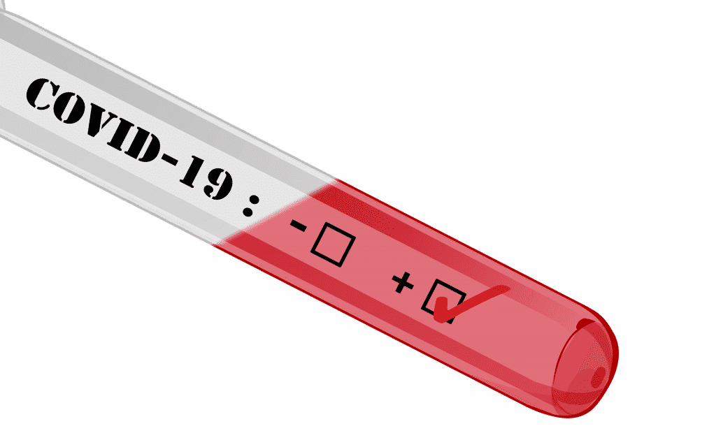 test coronavirus antigéniques pharmacies