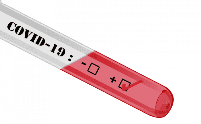 test coronavirus