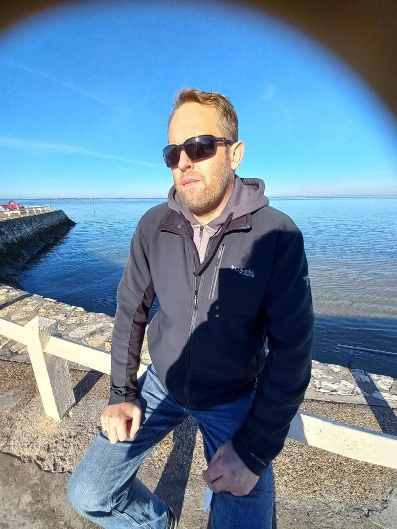 Julien greffe cornée articielle