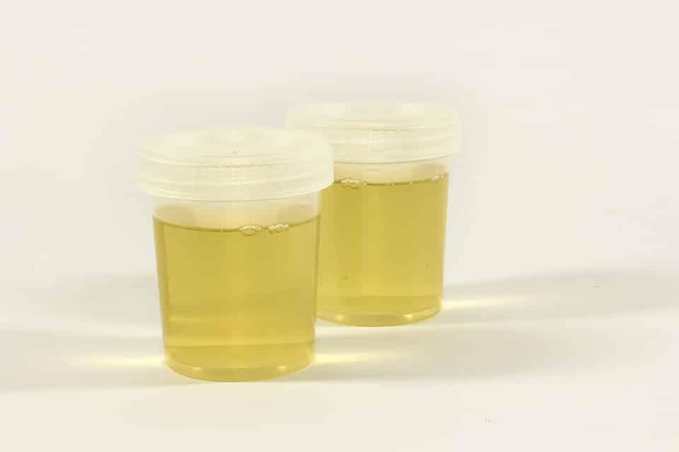 glyphosate urine Aude étude prélèvement 