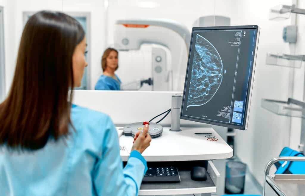 mammographie dépistage cancer sein